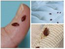 Bedbugs on the body and in bed