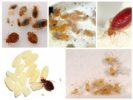 Lůžkoviny - jejich larvy a vejce