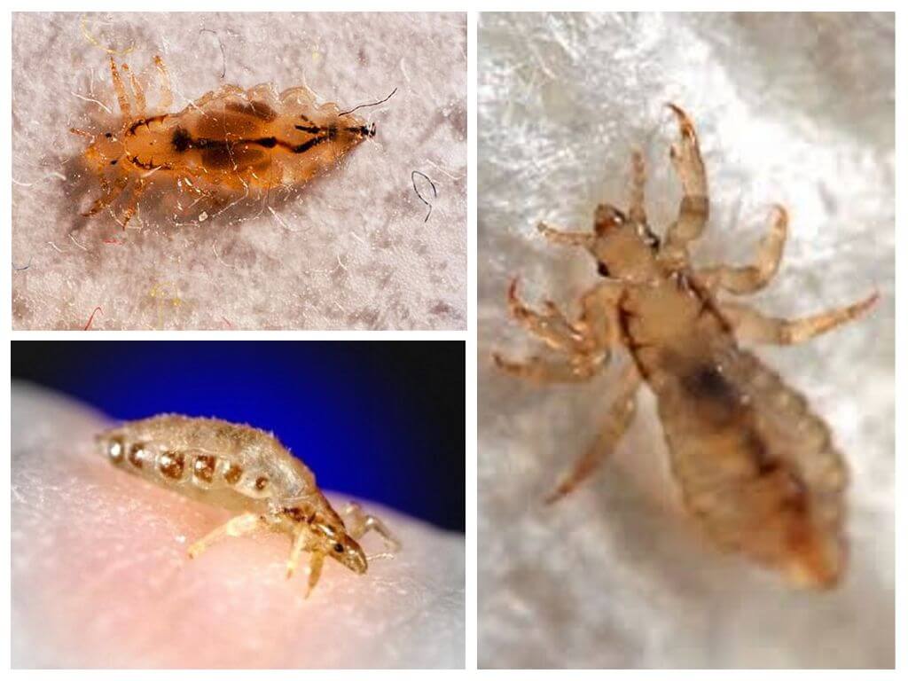 How to get rid of bed lice at home