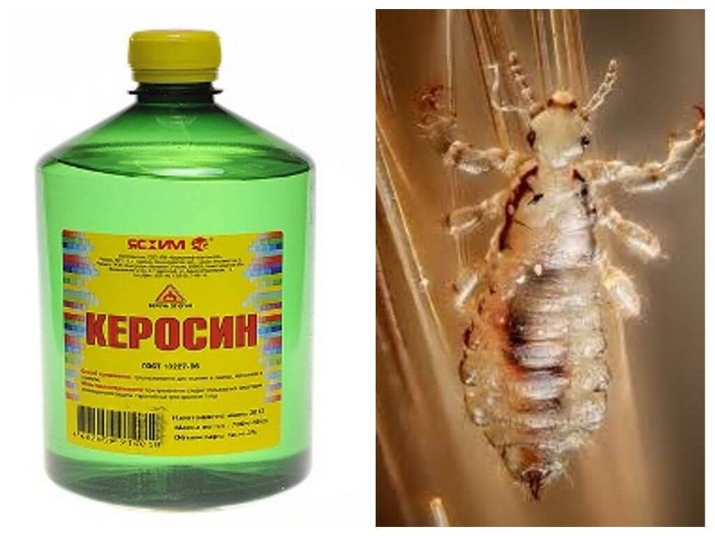 How to remove kerosene lice and nits