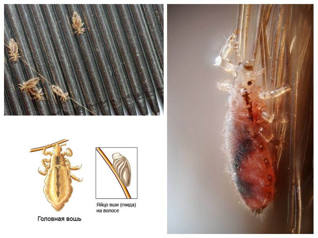 The incubation period of lice and nits in humans
