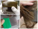 Combing lice and nits