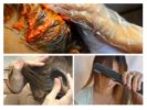 Uklanjanje gnjida u kosi