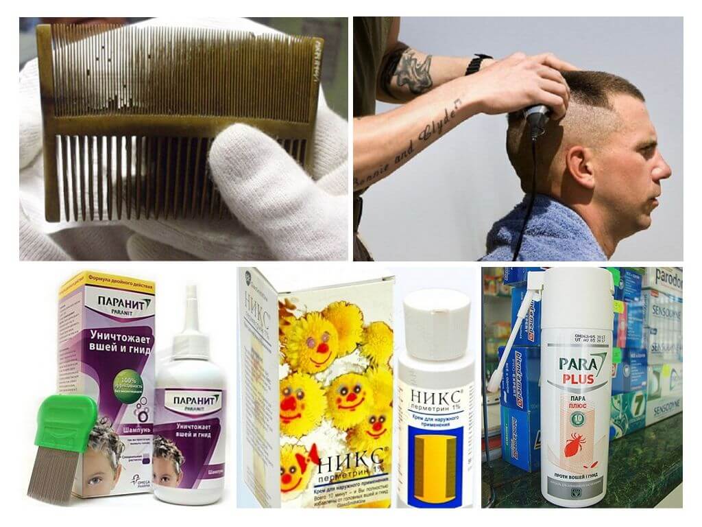 How and with what to remove lice in children