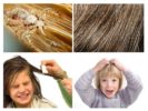 Signs of head lice