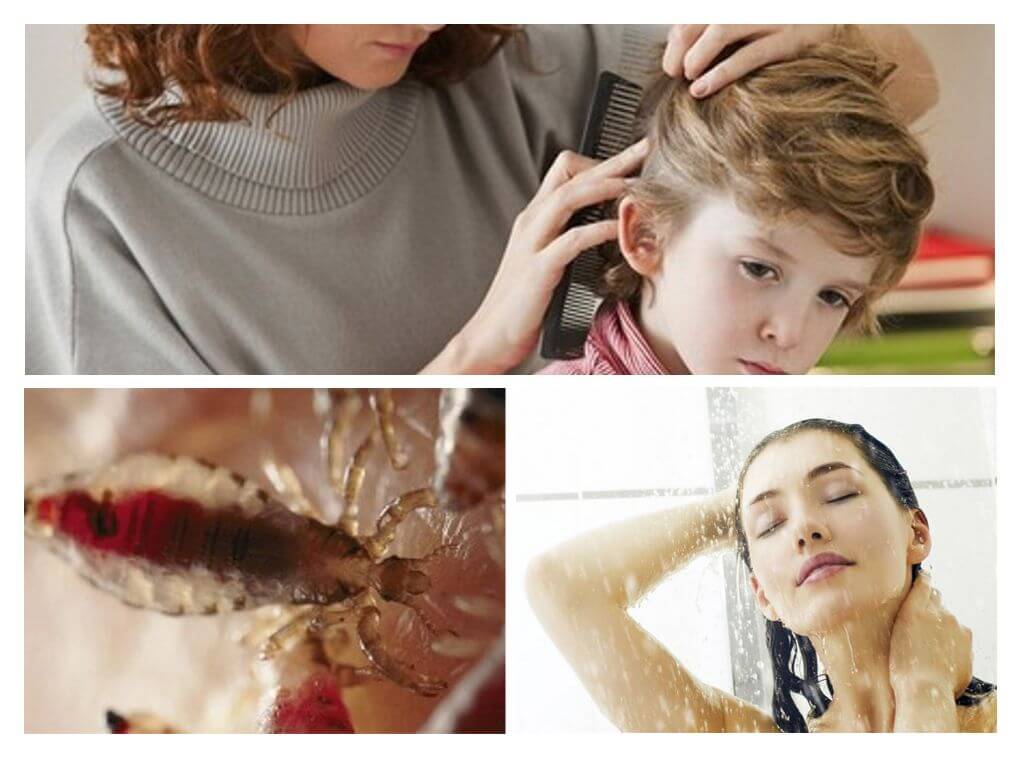 Prevention of head lice and typhus