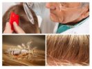 Examen des cheveux de la pédiculose