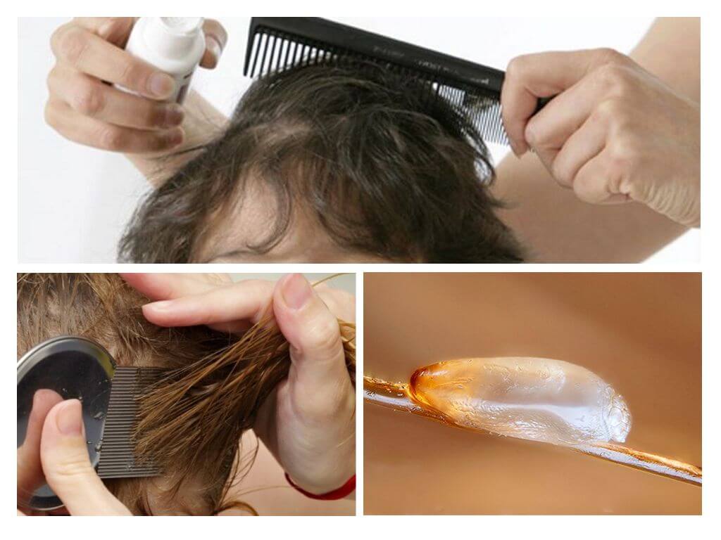 How to comb out nits