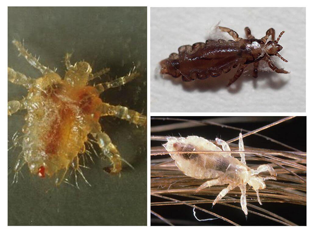Why lice appear, methods of struggle, lice prophylaxis