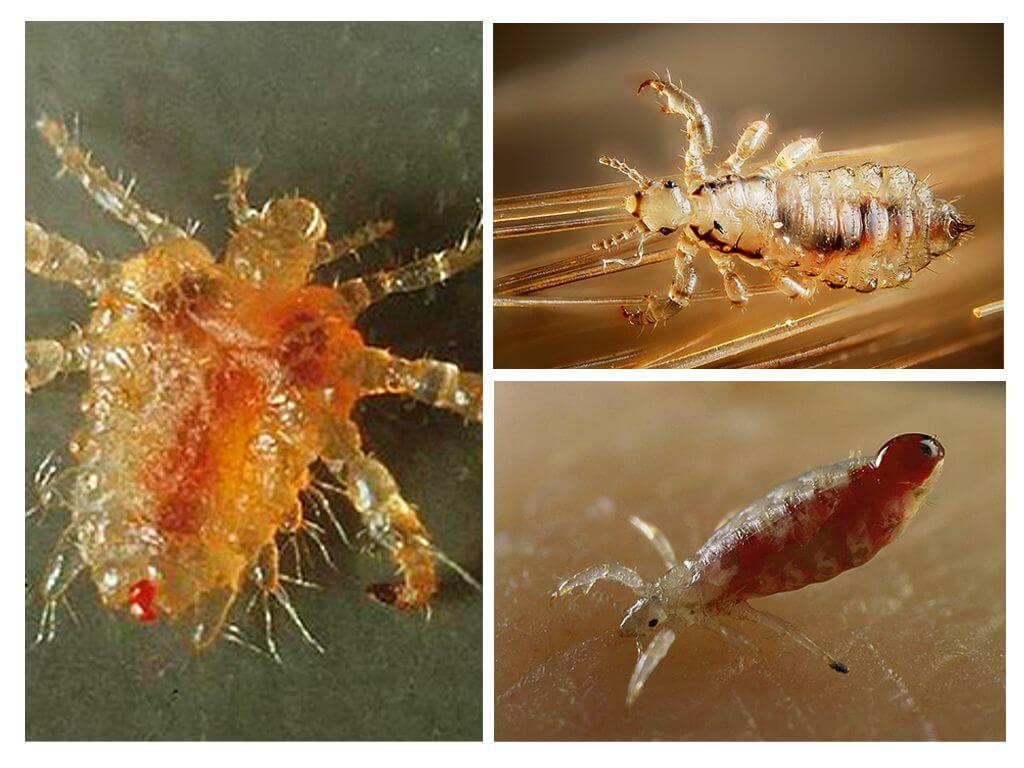 Types and varieties of lice
