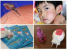 Detský raptor Nekusayka bude chrániť pred komármi