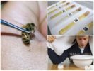 Liječenje pčelinjim otrovima