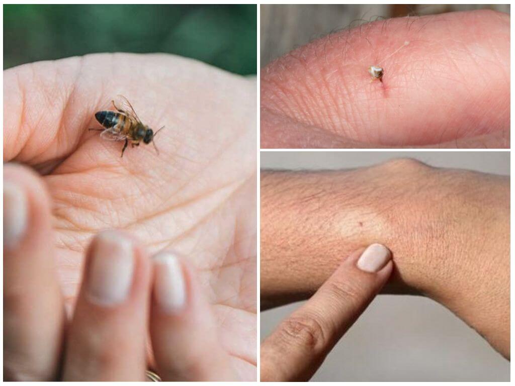 Who dies after being bitten by a bee or wasp