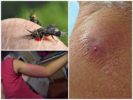 The consequences of a bite of a gadfly