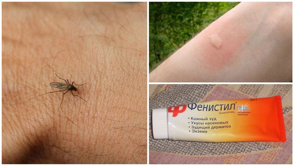 Jak a jak odstranit svědění z kousnutí komárů u dítěte a dospělého
