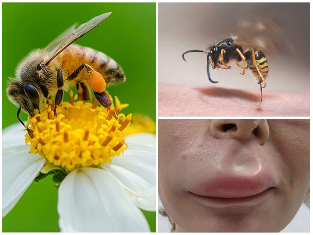 ماذا تفعل لو النحلة قليلا على الشفاه