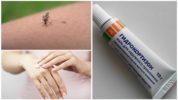 Hydrocortison-Salbe gegen Mückenstiche