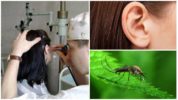 Mosquito in ear