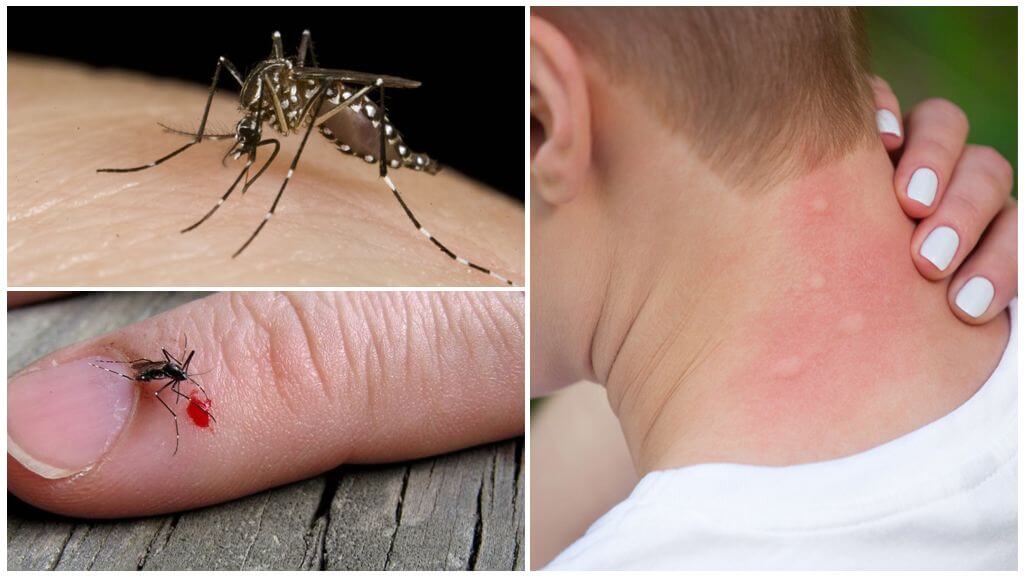 What to do if a mosquito bit