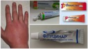 Ointments for mosquito bites