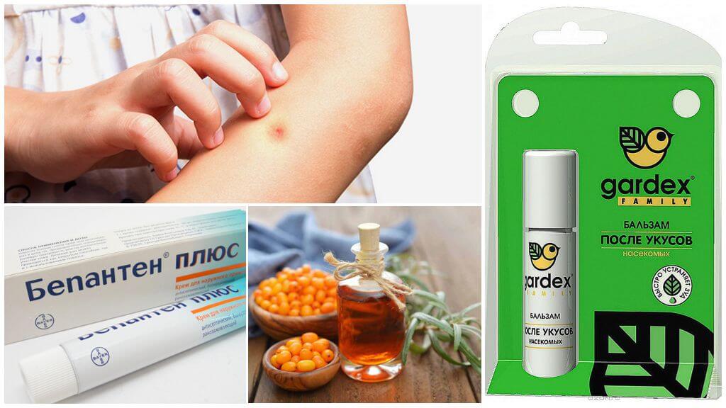 Shop and folk remedies for mosquito bites and midges