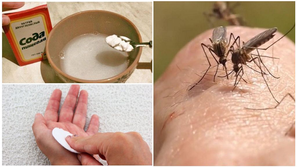Solución de soda para picaduras de mosquitos en niños y adultos.