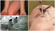 Fièvre dengue et chikungunya causée par les moustiques