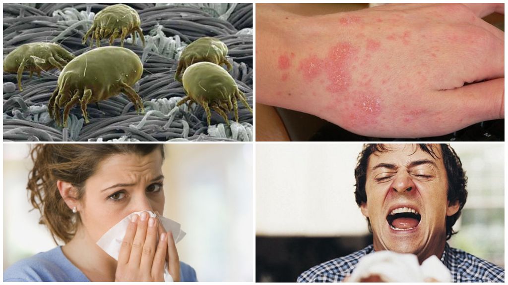 Allergie aux tiques