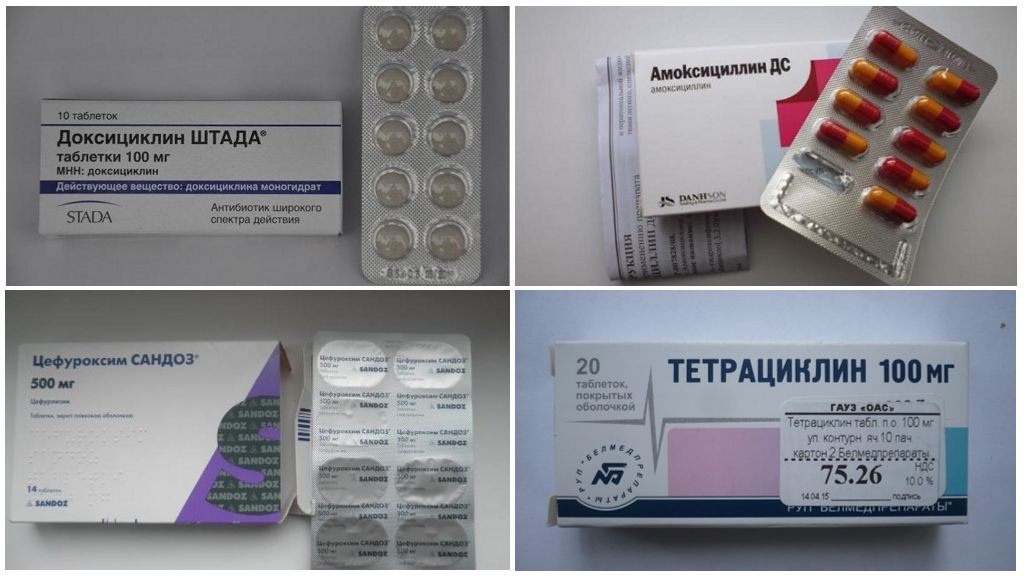 Antibiotiques dans les pilules contre la borréliose