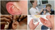 Comprehensive treatment of an ear tick