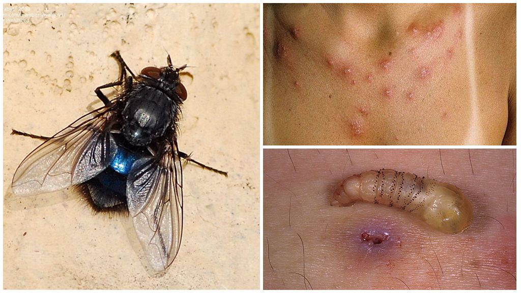 Une mouche qui dépose des larves sous la peau humaine