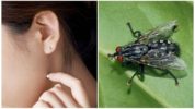 A fly in the auricle