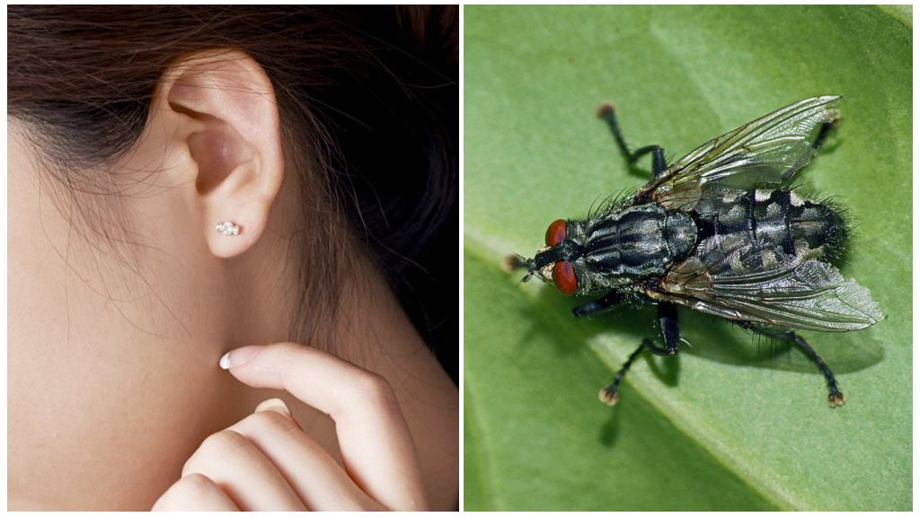 Wie man zu Hause eine Fliege aus dem Ohr bekommt
