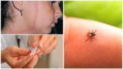 The consequences of a tick bite