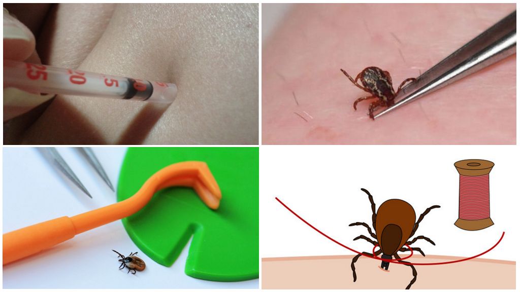 Can a tick be crushed with fingers