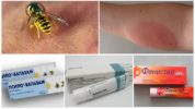 Antiallergic ointments for wasp stings