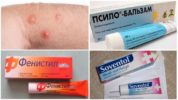 Antihistamine ointments for insect bites