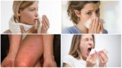 Roztočová alergie
