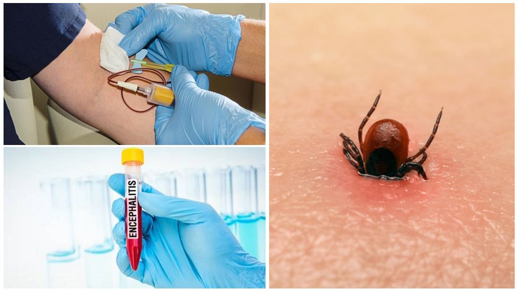 Ticks in Bashkiria: where to pass, tests, vaccinations, processing