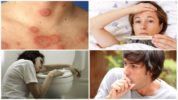 Symptoms of Borreliosis