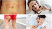 Symptome von durch Zecken übertragenem Typhus