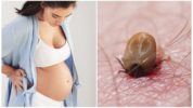 Morsure de tique pendant la grossesse