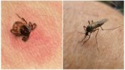 Tick ​​and mosquito bite