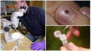 Tick ​​research in the laboratory